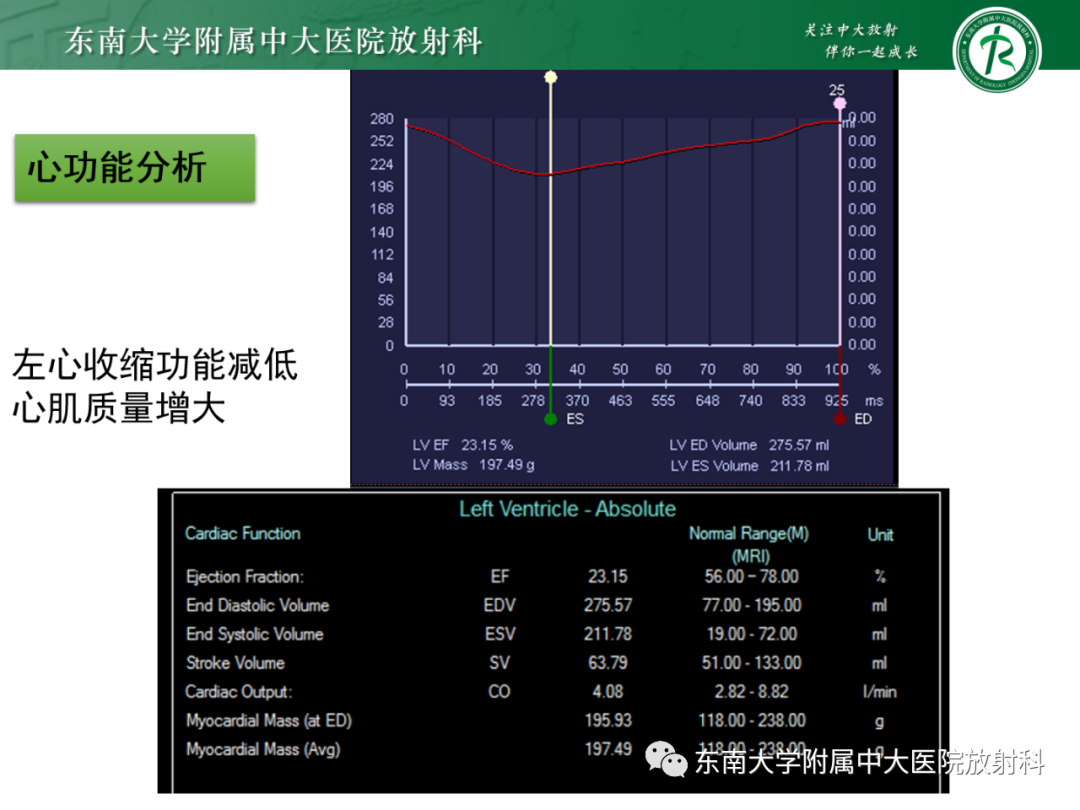 影像PPT - 【PPT】心脏结节病MR表现-20