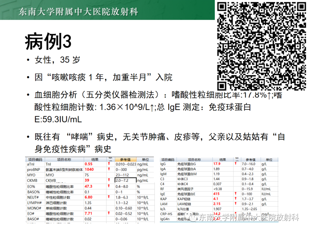 影像PPT - 【PPT】心脏结节病MR表现-29