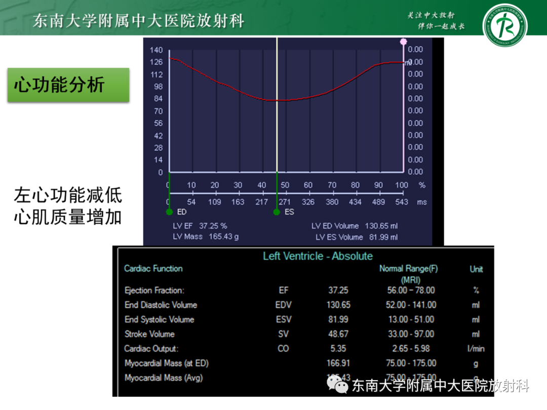 影像PPT - 【PPT】心脏结节病MR表现-32