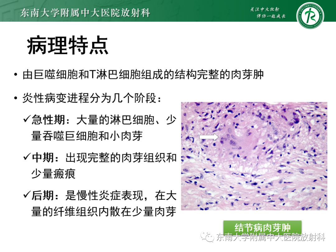 影像PPT - 【PPT】心脏结节病MR表现-51