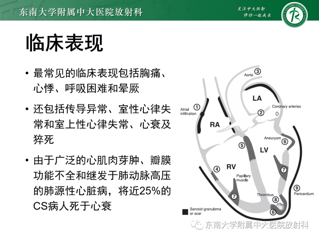 影像PPT - 【PPT】心脏结节病MR表现-54