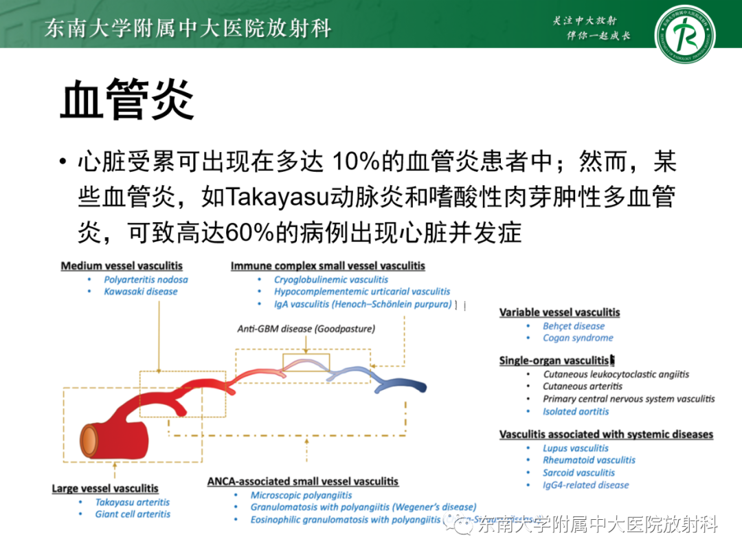 影像PPT - 【PPT】心脏结节病MR表现-70