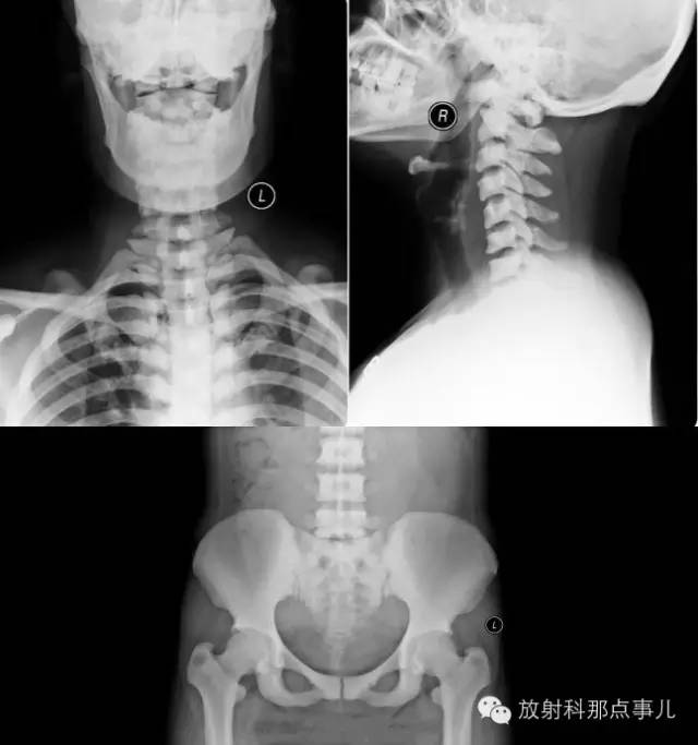 影像PPT - \ 影像PPT - \