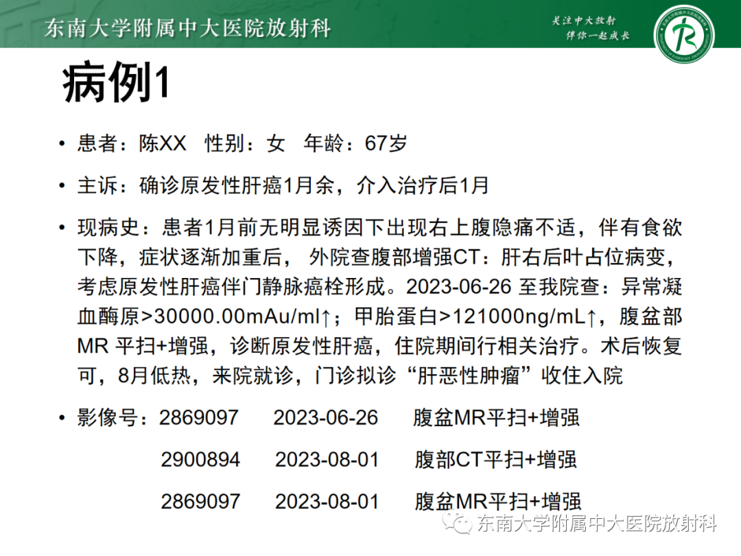 影像PPT - 【PPT】消化系统介入术后特殊并发症-4 影像PPT - 【PPT】消化系统介入术后特殊并发症-4