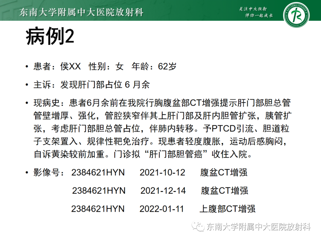 影像PPT - 【PPT】消化系统介入术后特殊并发症-21 影像PPT - 【PPT】消化系统介入术后特殊并发症-21