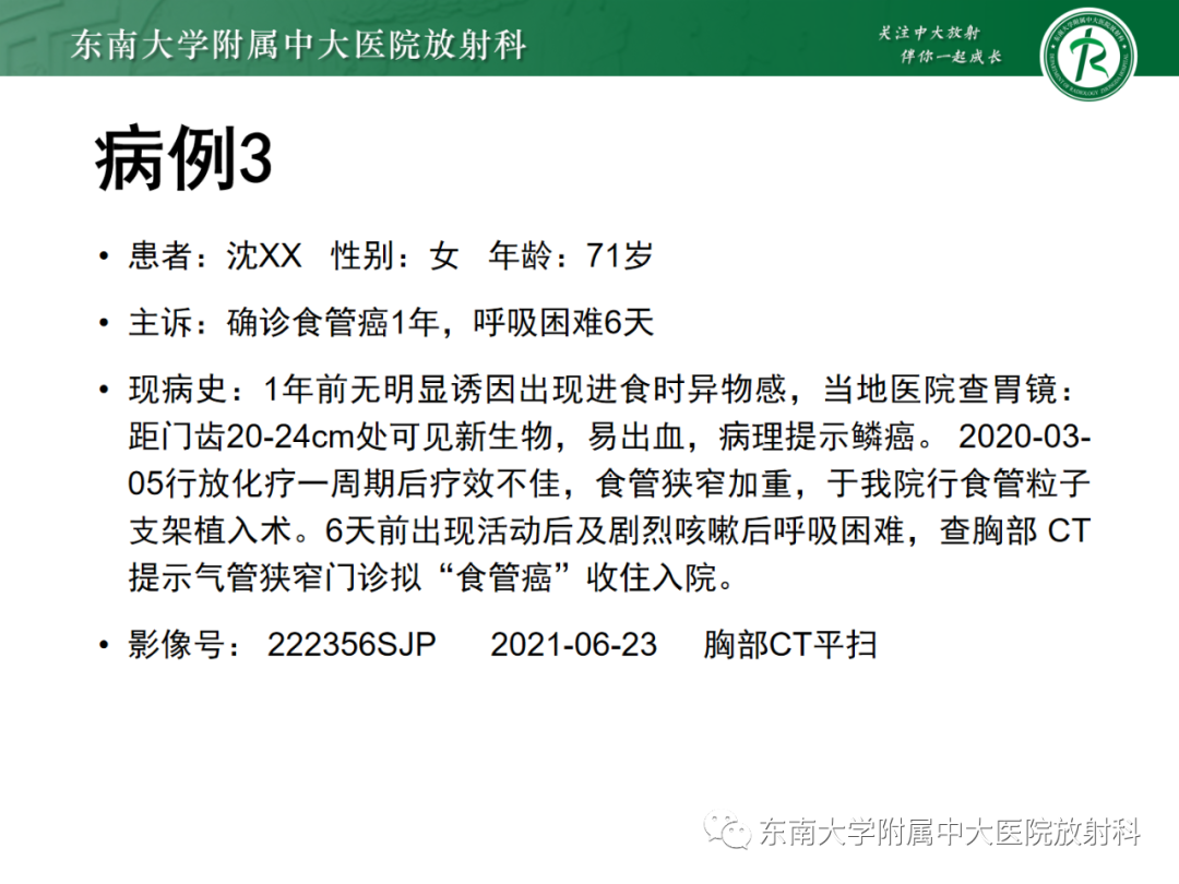 影像PPT - 【PPT】消化系统介入术后特殊并发症-28 影像PPT - 【PPT】消化系统介入术后特殊并发症-28