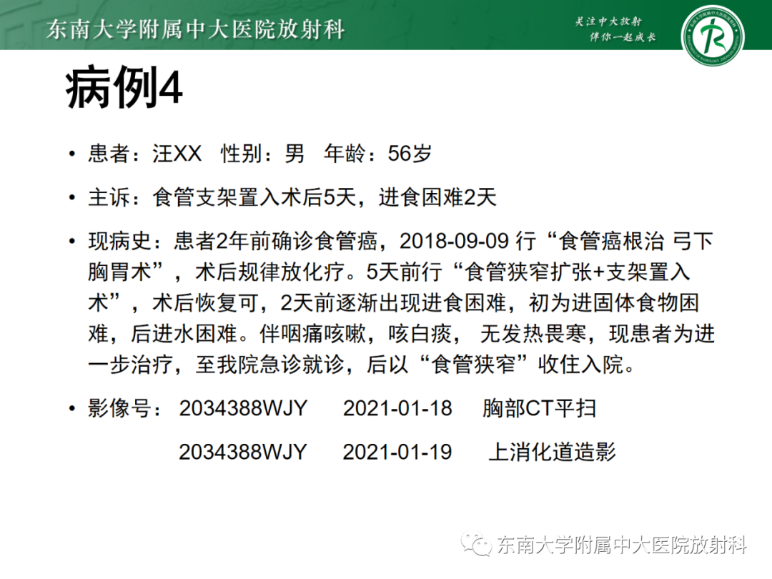 影像PPT - 【PPT】消化系统介入术后特殊并发症-36 影像PPT - 【PPT】消化系统介入术后特殊并发症-36