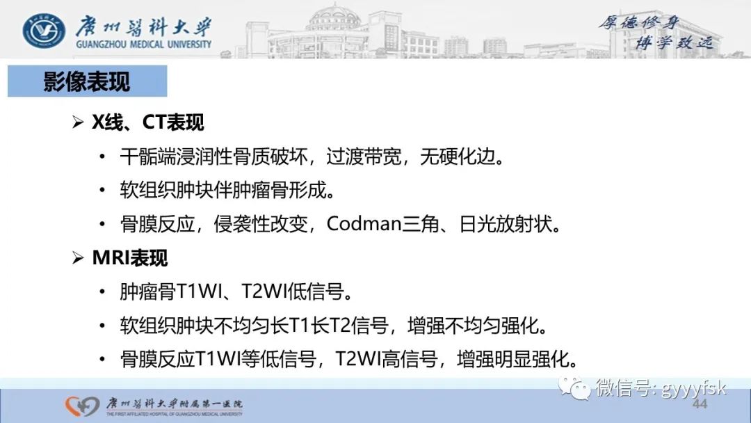影像PPT - 【病例】股骨骨肉瘤1例X线CT及MR影像-44