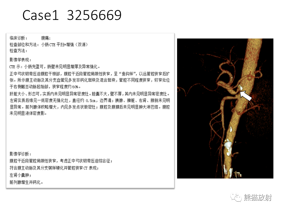 影像PPT - 【病例】正中弓状韧带综合征2例CT影像-11