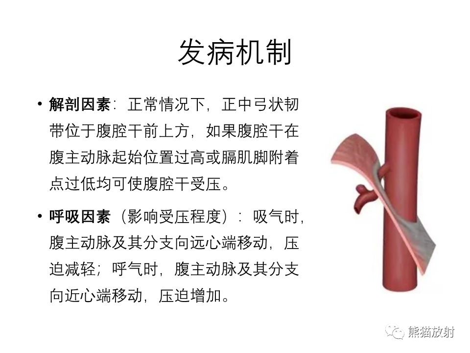 影像PPT - 【病例】正中弓状韧带综合征2例CT影像-16