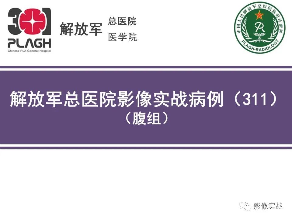 影像PPT - 【病例】肝细胞腺瘤1例MR影像-1