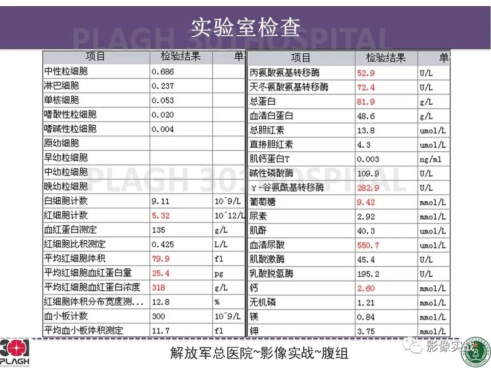 影像PPT - 【病例】肝细胞腺瘤1例MR影像-4
