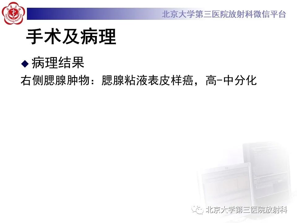 影像PPT - 【PPT】腮腺粘液表皮样癌-7