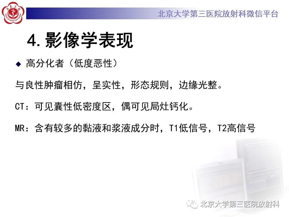 影像PPT - 【PPT】腮腺粘液表皮样癌-15