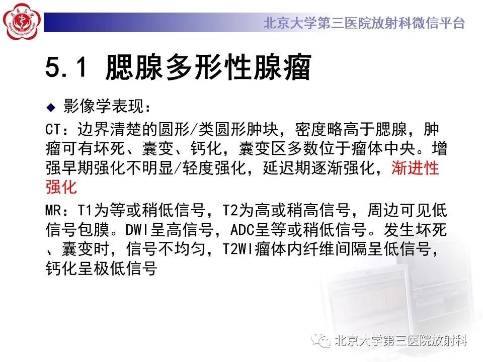影像PPT - 【PPT】腮腺粘液表皮样癌-22