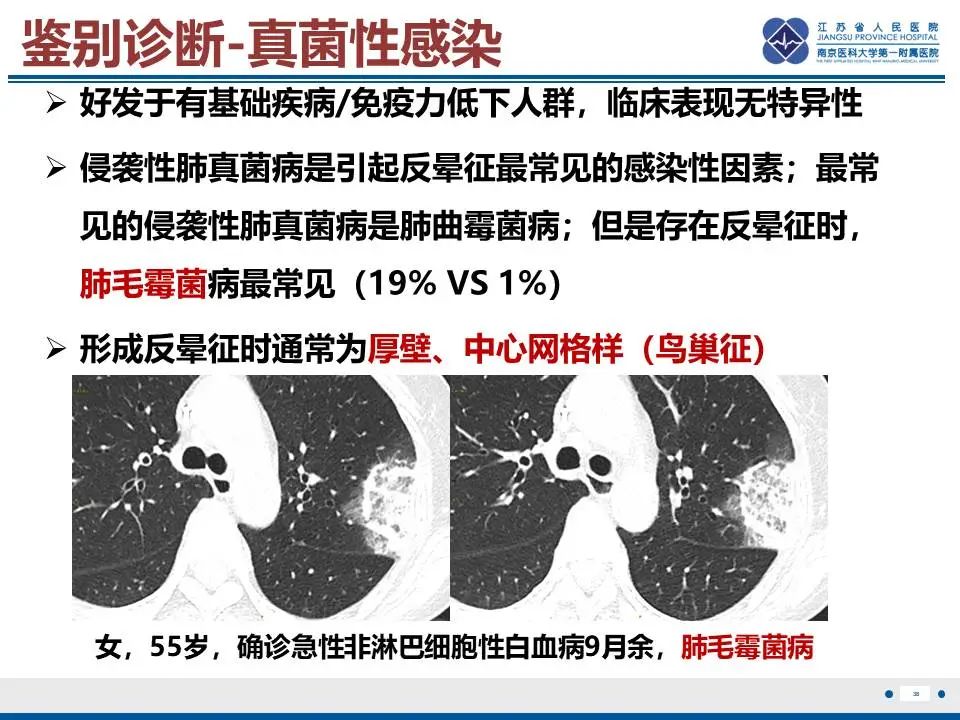 影像PPT - 【PPT】肺梗死-39