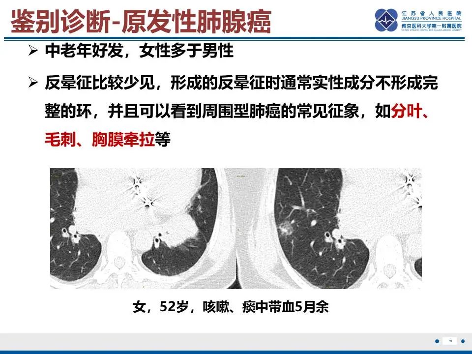 影像PPT - 【PPT】肺梗死-40