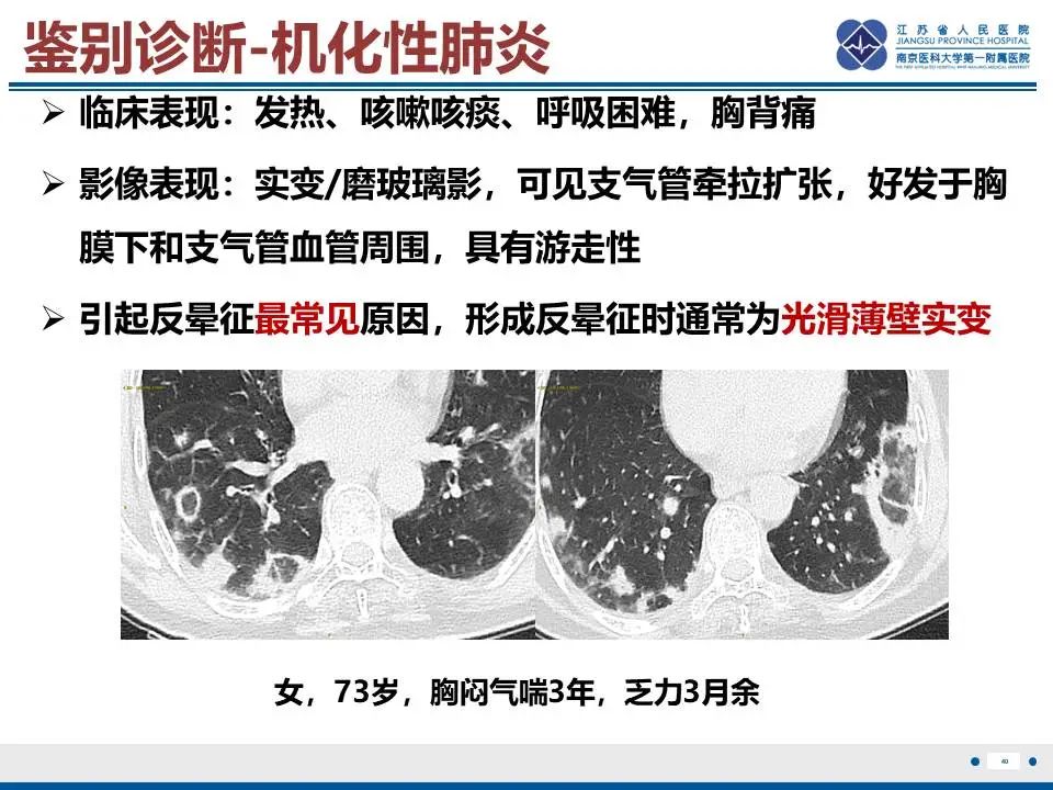 影像PPT - 【PPT】肺梗死-41