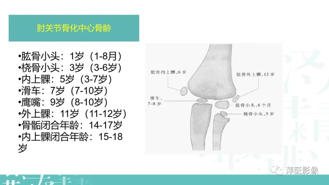 影像PPT - 【PPT】儿童肘关节损伤X线表现-4