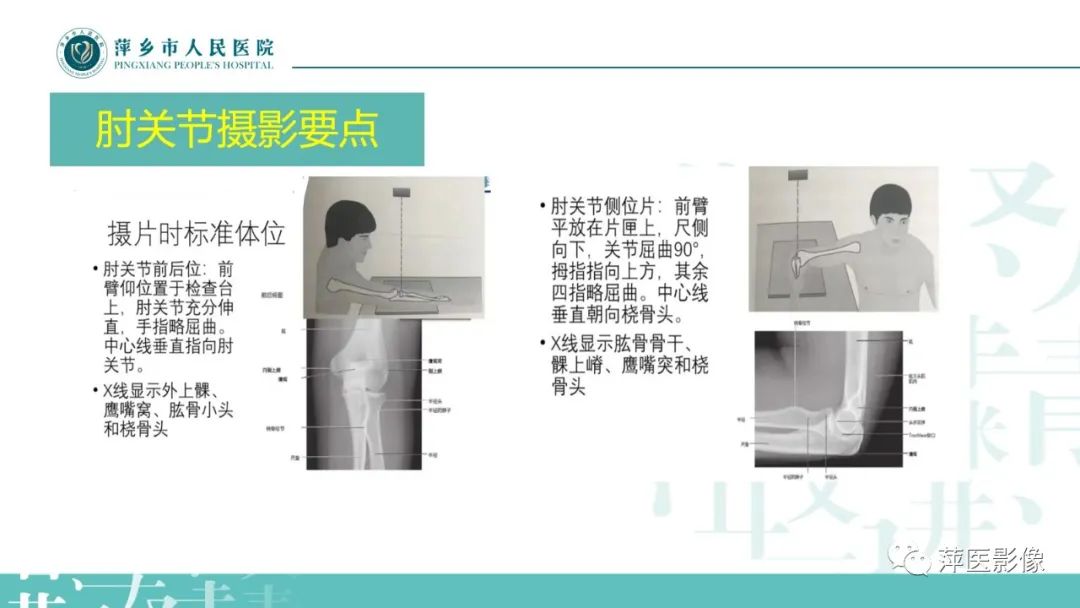 影像PPT - 【PPT】儿童肘关节损伤X线表现-13