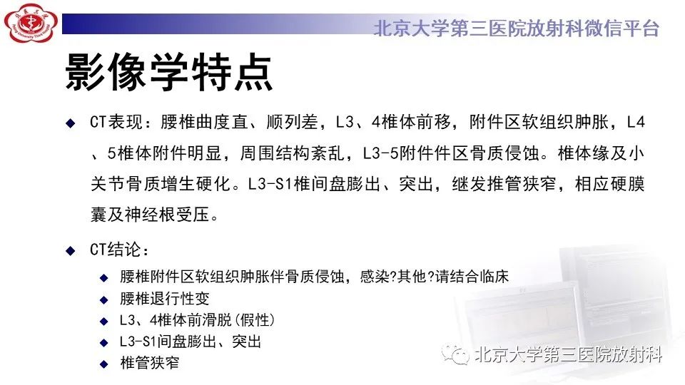 影像PPT - 【PPT】布鲁氏菌性脊柱炎-6