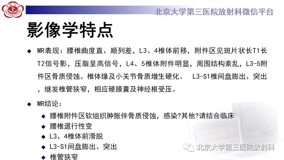 影像PPT - 【PPT】布鲁氏菌性脊柱炎-7