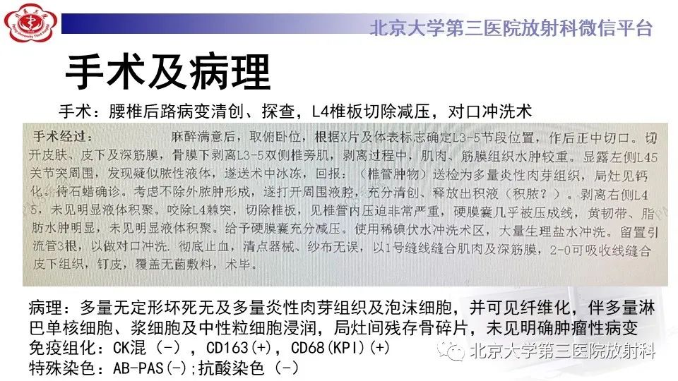 影像PPT - 【PPT】布鲁氏菌性脊柱炎-8