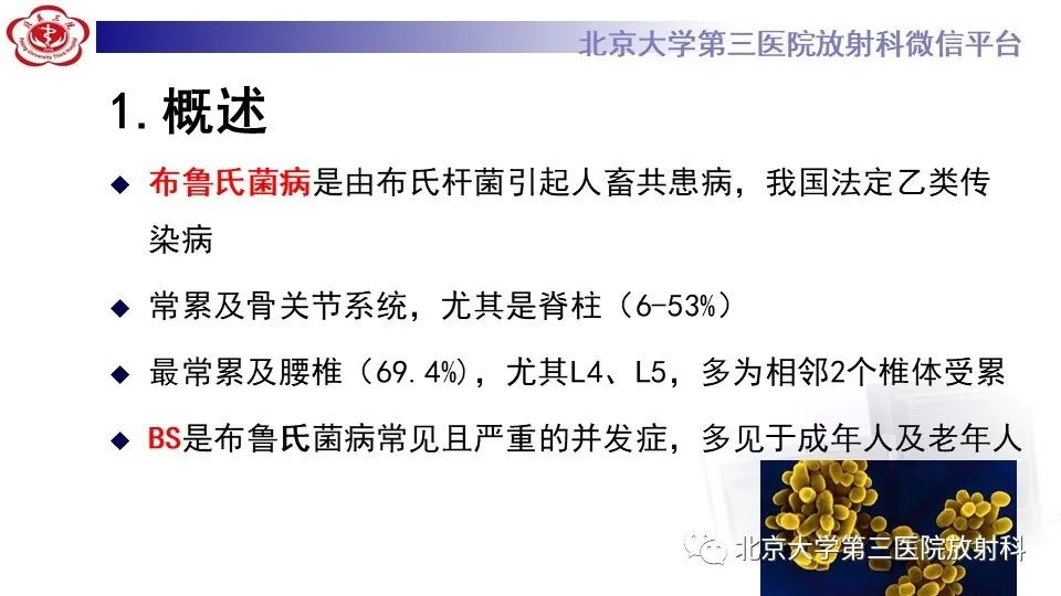 影像PPT - 【PPT】布鲁氏菌性脊柱炎-11