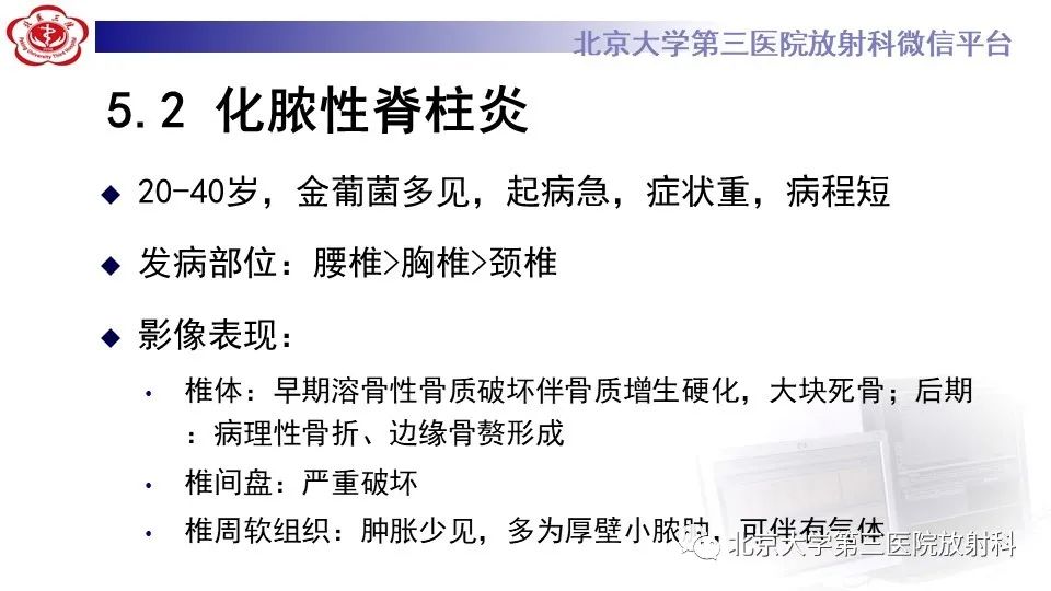 影像PPT - 【PPT】布鲁氏菌性脊柱炎-28