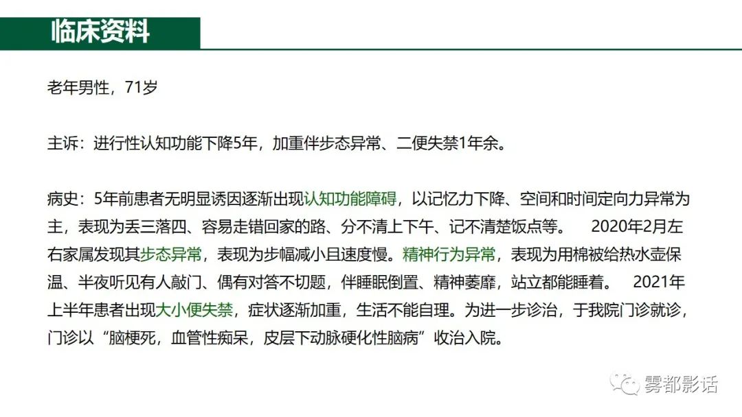 影像PPT - 【PPT】特发性正常压力脑积水的影像诊断-1