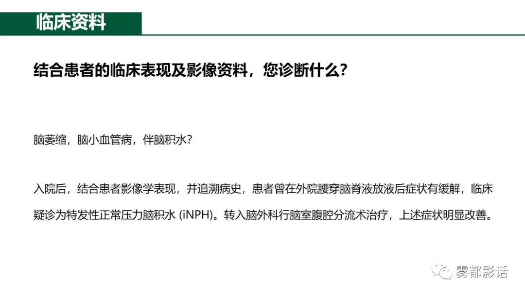 影像PPT - 【PPT】特发性正常压力脑积水的影像诊断-2