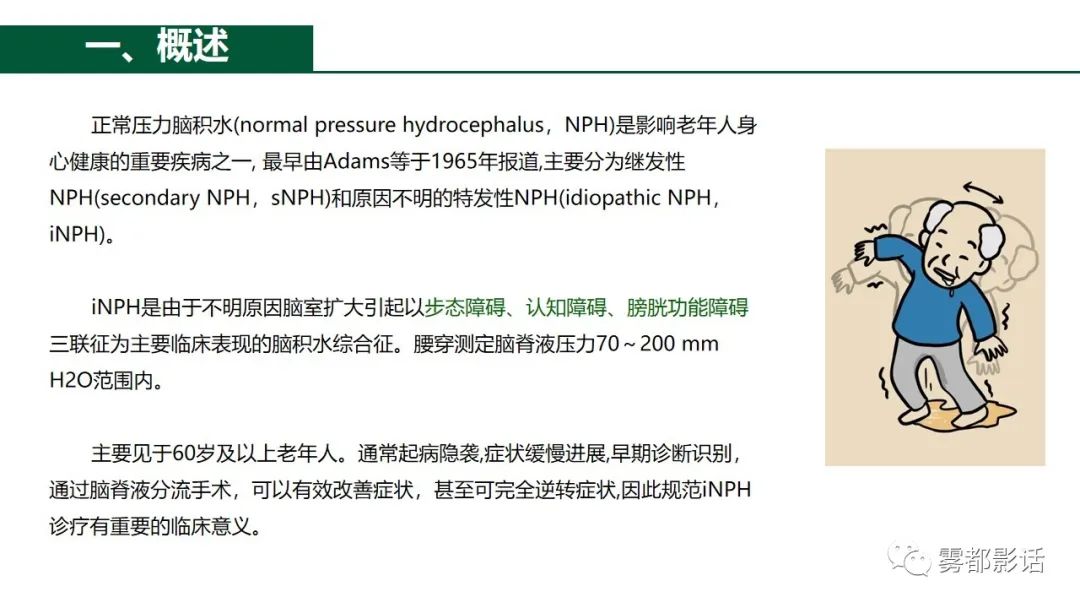 影像PPT - 【PPT】特发性正常压力脑积水的影像诊断-5
