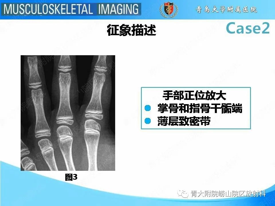 影像PPT - 【PPT】干骺端致密带-12