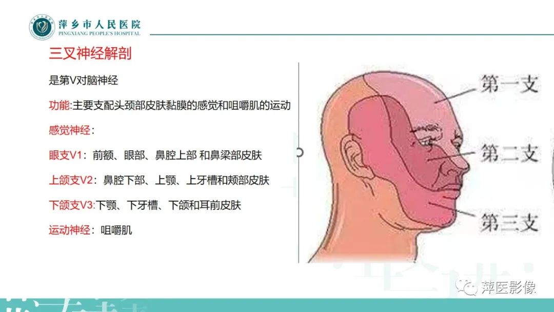 影像PPT - 【PPT】三叉神经痛-3