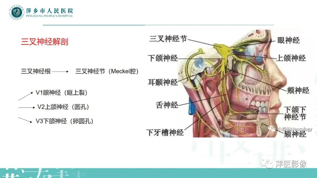 影像PPT - 【PPT】三叉神经痛-4