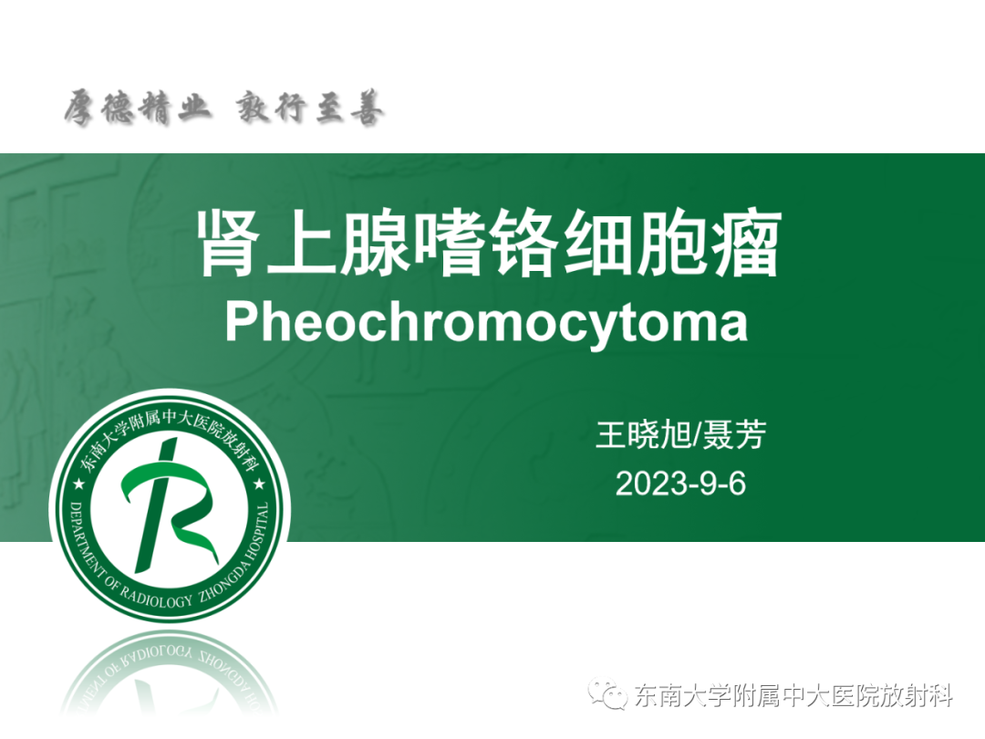 影像PPT - 【PPT】肾上腺嗜铬细胞瘤-4 影像PPT - 【PPT】肾上腺嗜铬细胞瘤-4