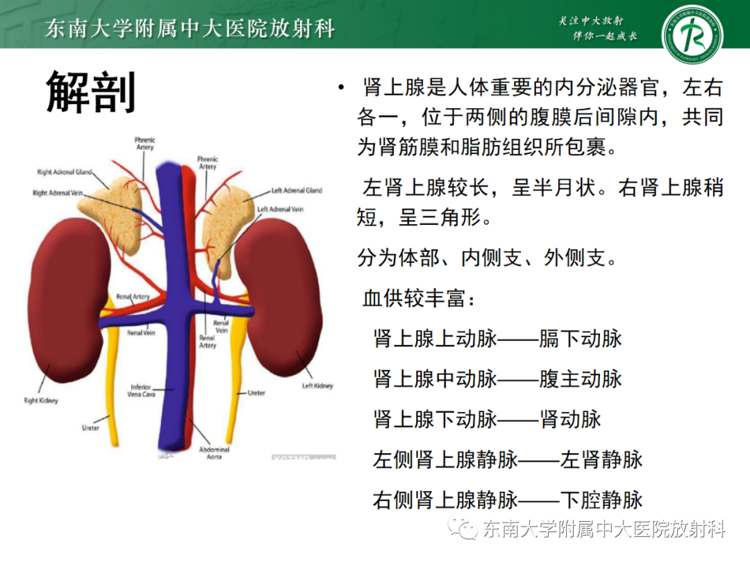 影像PPT - 【PPT】肾上腺嗜铬细胞瘤-5 影像PPT - 【PPT】肾上腺嗜铬细胞瘤-5