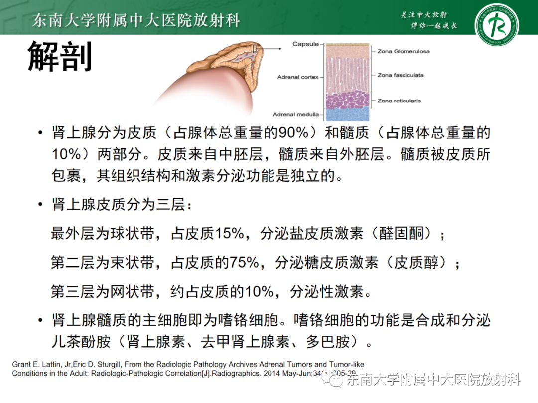 影像PPT - 【PPT】肾上腺嗜铬细胞瘤-6 影像PPT - 【PPT】肾上腺嗜铬细胞瘤-6