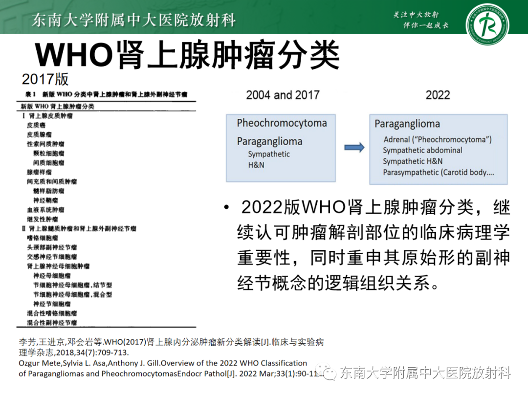 影像PPT - 【PPT】肾上腺嗜铬细胞瘤-8 影像PPT - 【PPT】肾上腺嗜铬细胞瘤-8