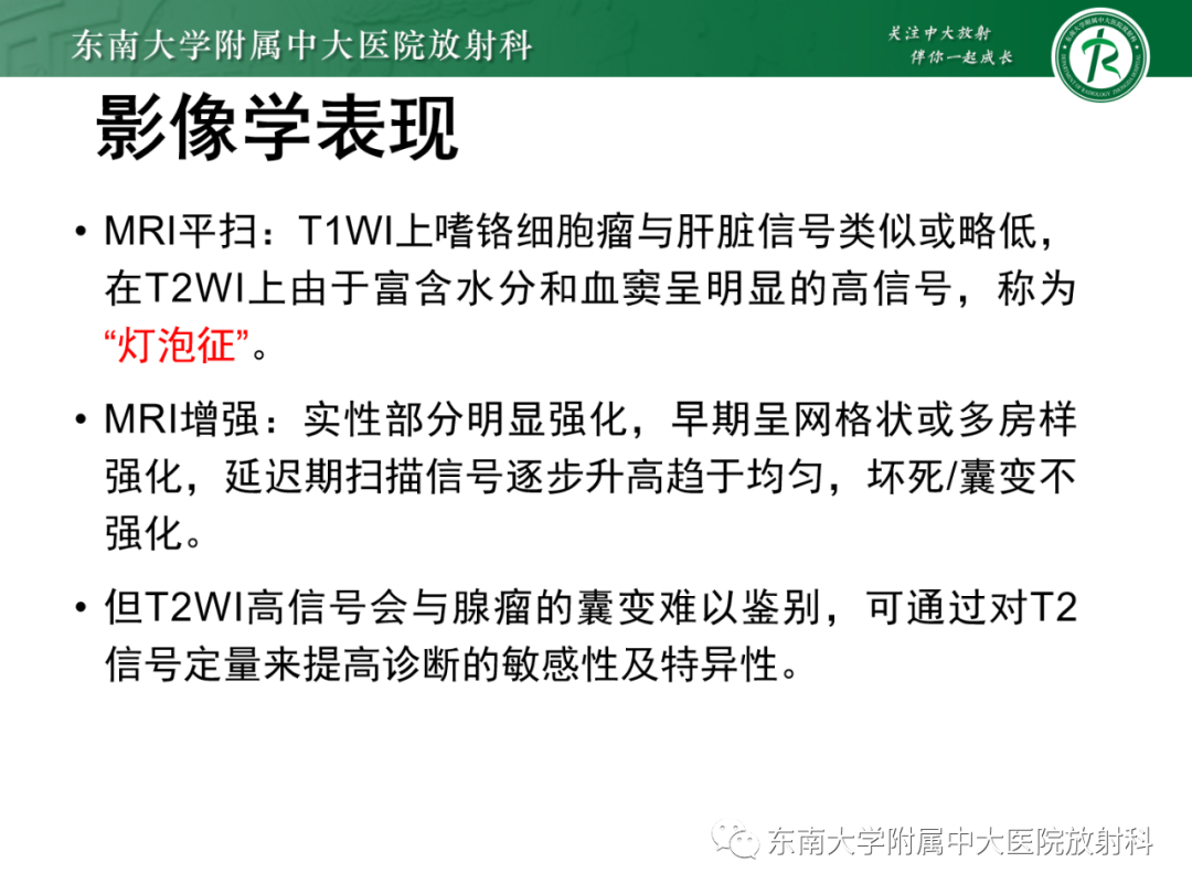 影像PPT - 【PPT】肾上腺嗜铬细胞瘤-13 影像PPT - 【PPT】肾上腺嗜铬细胞瘤-13