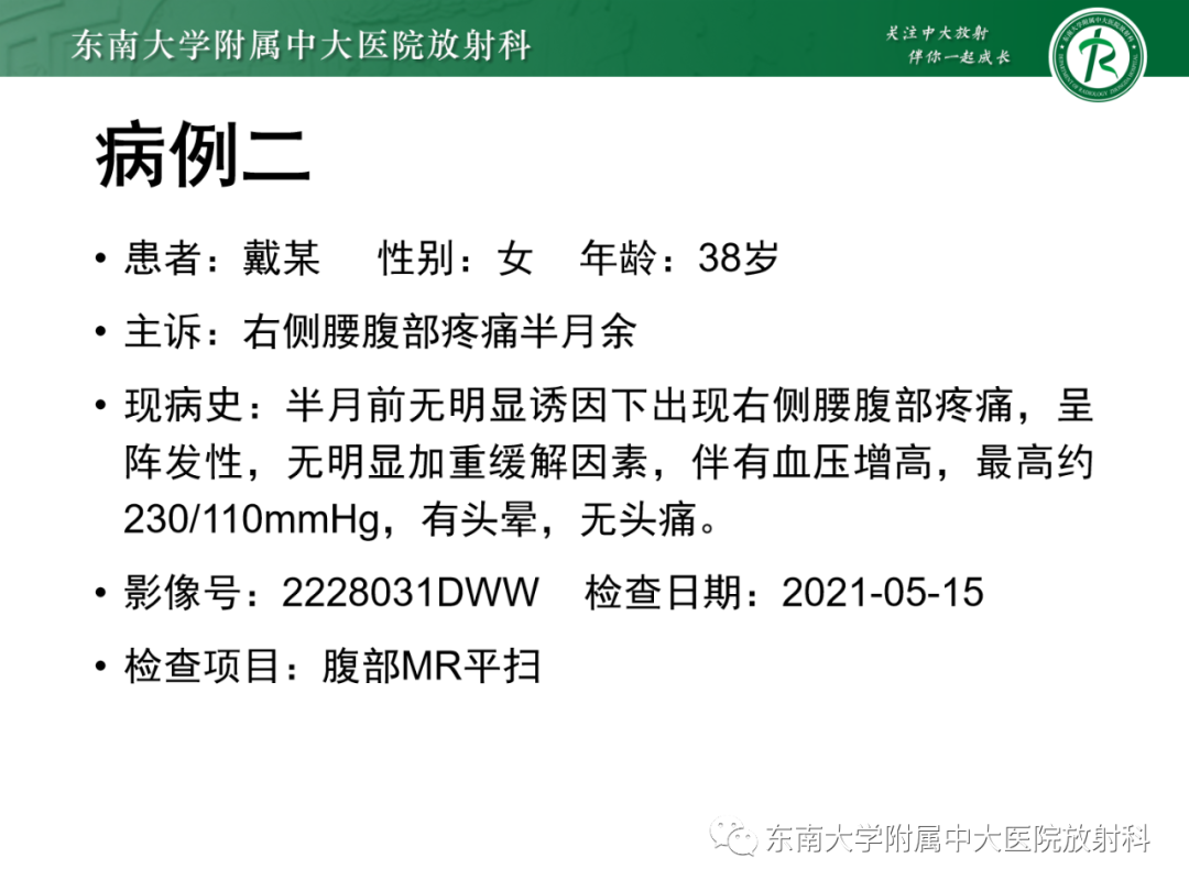 影像PPT - 【PPT】肾上腺嗜铬细胞瘤-15 影像PPT - 【PPT】肾上腺嗜铬细胞瘤-15