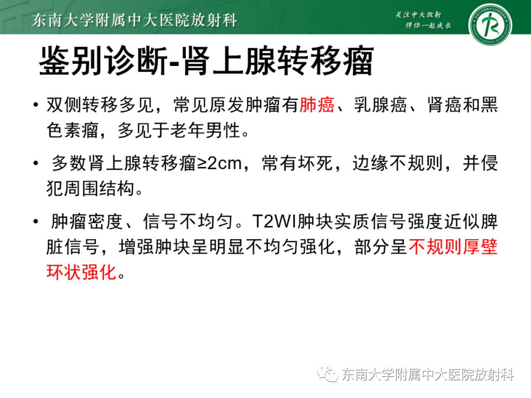 影像PPT - 【PPT】肾上腺嗜铬细胞瘤-30 影像PPT - 【PPT】肾上腺嗜铬细胞瘤-30