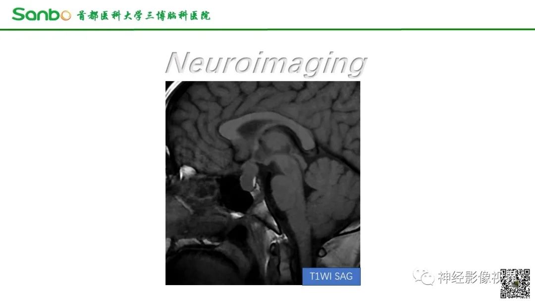 影像PPT - 【病例】垂体增生1例CT及MR影像-3 影像PPT - 【病例】垂体增生1例CT及MR影像-3