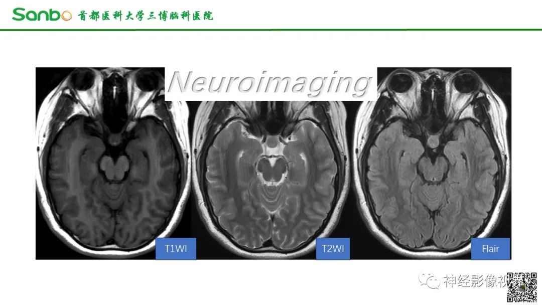 影像PPT - 【病例】垂体增生1例CT及MR影像-2 影像PPT - 【病例】垂体增生1例CT及MR影像-2