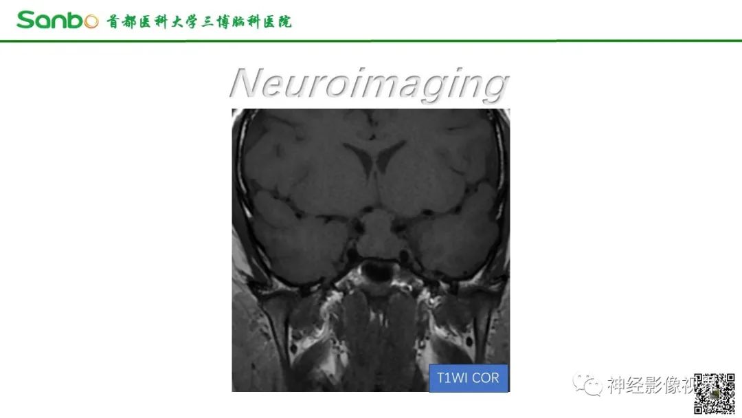 影像PPT - 【病例】垂体增生1例CT及MR影像-4 影像PPT - 【病例】垂体增生1例CT及MR影像-4