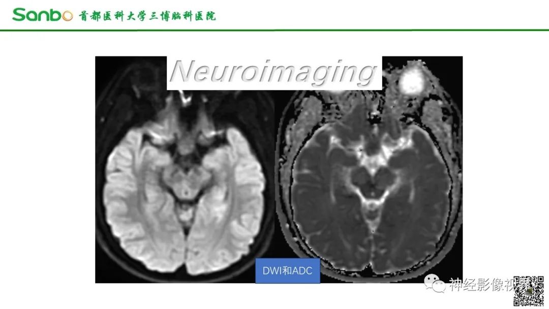 影像PPT - 【病例】垂体增生1例CT及MR影像-5 影像PPT - 【病例】垂体增生1例CT及MR影像-5