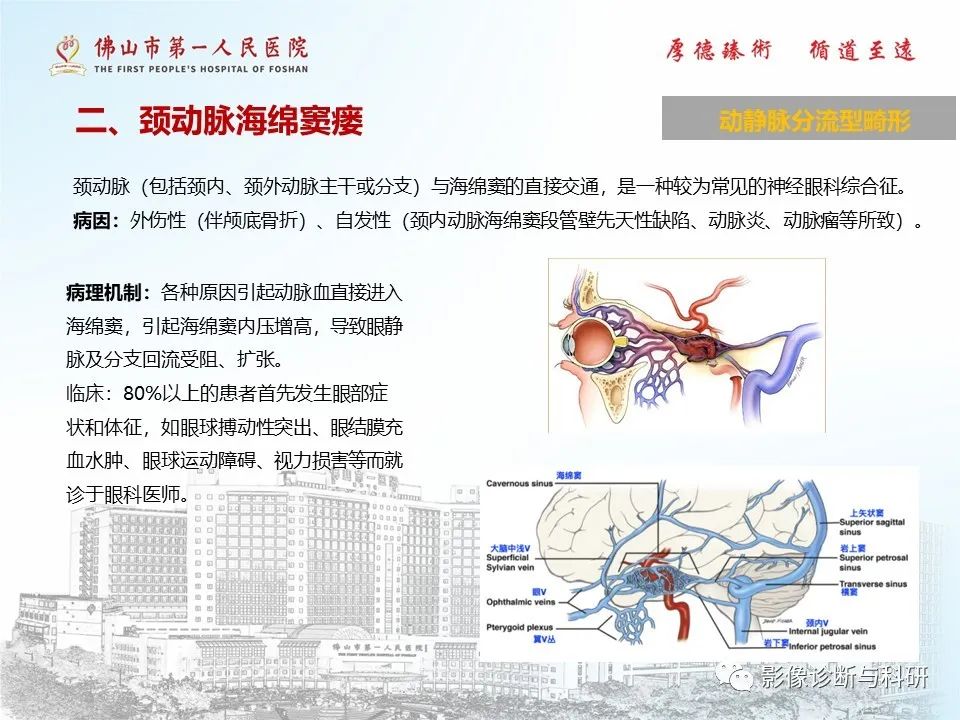 影像PPT - 【PPT】脑血管畸形的影像诊断-9