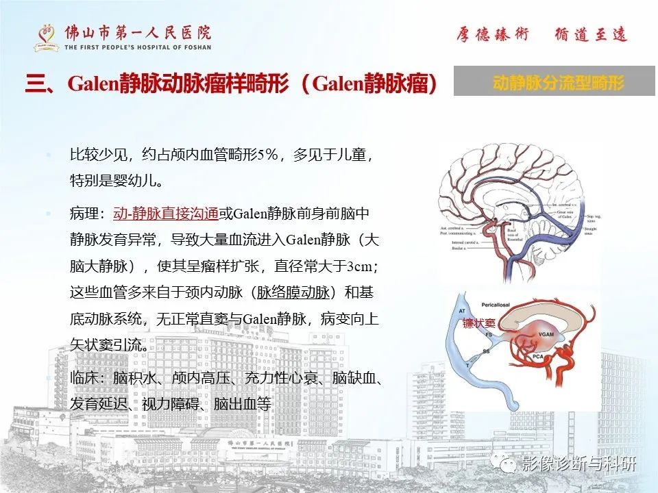 影像PPT - 【PPT】脑血管畸形的影像诊断-16
