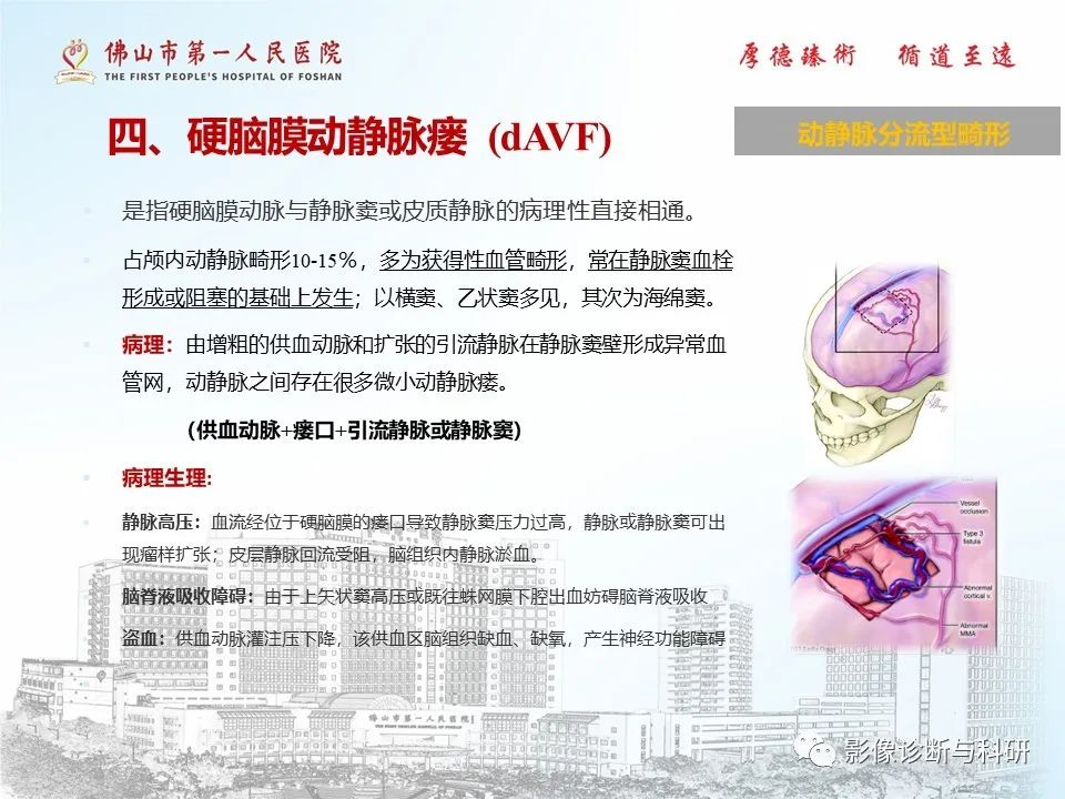 影像PPT - 【PPT】脑血管畸形的影像诊断-22