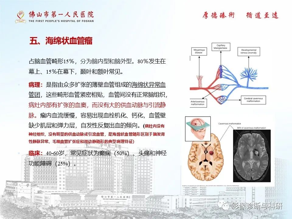 影像PPT - 【PPT】脑血管畸形的影像诊断-31